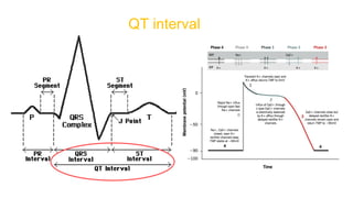 QT interval
 