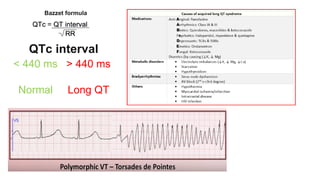 QTc interval
< 440 ms > 440 ms
Normal Long QT Long QT
Bazzet formula
 