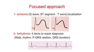 Focused approach
1- Ischemia (Q wave, ST segment , T wave),localization
2- Arrhythmia: 4 items to reach diagnosis
(Rate, rhythm, P-QRS relation, QRS duration)
 