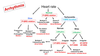 Heart rate
Slow
Tachycardia
Normal
P-QRS relation
Progressive
PR
Prolongation
Mobitz I
Multiple P
Followed by QRS
Fixed PR
Mobitz II
No relation
between
P /QRS
Complete AV block
Multiple P
Followed by QRS
Atrial flutter
1-QRS duration
Narrow Wide
2-Rhythm 2-Rhythm
Regular Regular
Irregular Irregular
3-P-QRS relation VT
SVT+BBB
AF+WPW
AF+BBB
Multiple P
Followed by QRS
Atrial flutter
QRS followed by P
Or no P
SVT
Multiple P
Followed by QRS
Atrial flutter+ variable block
Absent P
Atrial fibrillation
P-QRS relation
Absent P
Irregular
Atrial fibrillation
 