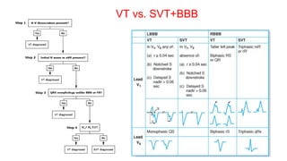 VT vs. SVT+BBB
 