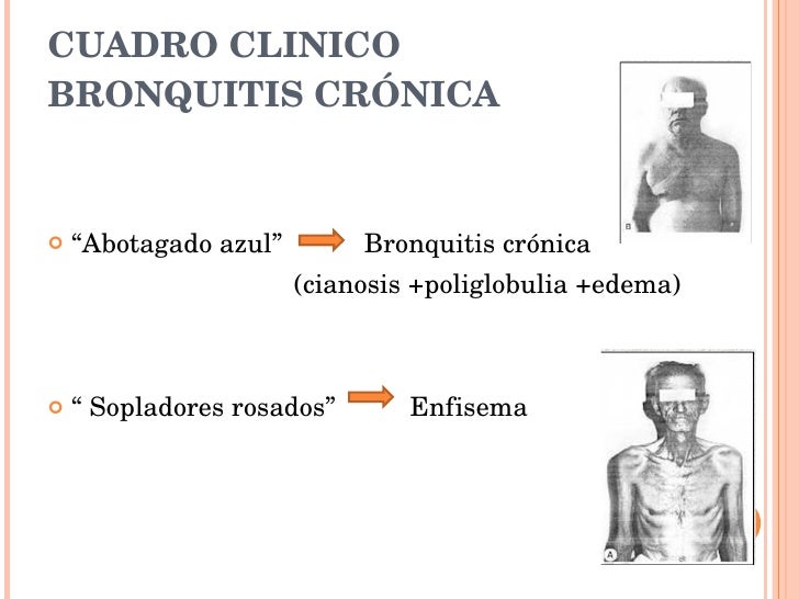 ABOTAGADO AZUL EBOOK DOWNLOAD ABOTAGADO AZUL EBOOK DOWNLOAD