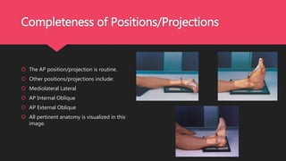 Final Image Evaluation - AP Ankle | PPTX