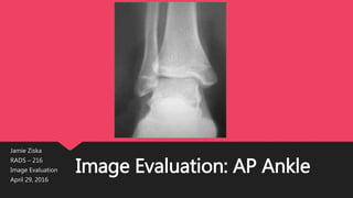 Image Evaluation: AP Ankle
Jamie Ziska
RADS – 216
Image Evaluation
April 29, 2016
 