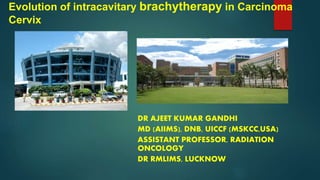 Evolution of intracavitary brachytherapy in Carcinoma
Cervix
DR AJEET KUMAR GANDHI
MD (AIIMS), DNB, UICCF (MSKCC,USA)
ASSISTANT PROFESSOR, RADIATION
ONCOLOGY
DR RMLIMS, LUCKNOW
 