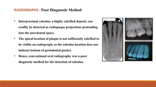 dental calculus and preventive measures DH | PPTX