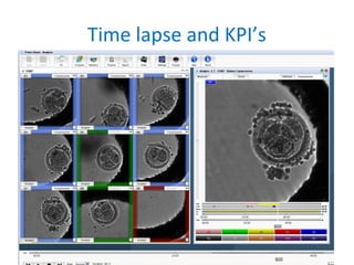 Time lapse and KPI’s
 
