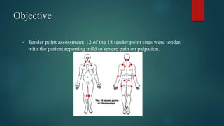 Objective
 Tender point assessment: 12 of the 18 tender point sites were tender,
with the patient reporting mild to severe pain on palpation.
 