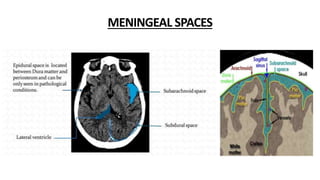 Radiological anatomy of brain | PPTX