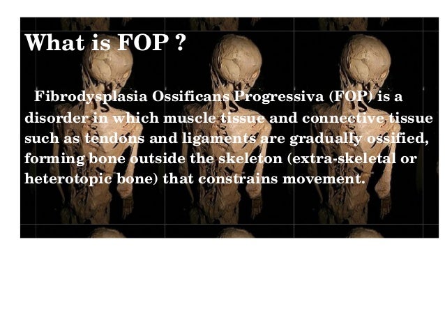 Fibrodysplasia ossificans progressiva