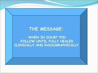 THE MESSAGE:
       -WHEN IN DOUBT PIN
   -FOLLOW UNTIL FULLY HEALED
CLINICALLY AND RADIOGRAPHICALLY
 