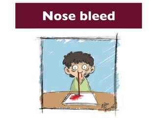 Nose bleed 
