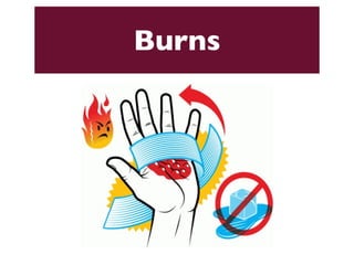Burns 