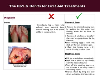 Diagnosis Burns Never put ice on the burn, as it’ll delay healing or cause extra damage (think frostbite).  Also, leave the butter in the kitchen, unless you want to make it worse. Do not break blisters and attempt to remove the skin, as it can cause infection 1 st  Degree burn . Put the burned part in cold water. 2 nd  Degree Burn ●   Put the burned part in cold water. ● Put cold, wet dressing on burn. Cover the burn with a loose bandage (or clean washed cotton sheet for a larger area) and go to the doctor. 3 rd  Degree Burn ● Leave burned clothes on the skin ● If face is burned, keep victim sitting up ● Keep airway open, tilt head back ● Evaluate burned arms, legs, hands. Keep burn higher than heart. ● Call for an ambulance   The Do’s & Don’ts for First Aid Treatments 