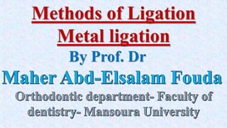 Methods of Ligation
Metal ligation
By Prof. Dr
 