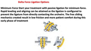 Delta Force Ligation Options
Minimum Force Start your treatment with passive ligation for minimum force.
Rapid leveling and aligning can be attained as the ligation is configured to
prevent the ligature from directly contacting the archwire. The free sliding
mechanics created result in low friction and more patient comfort during this
early phase of treatment
 