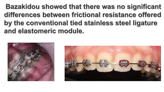 Bazakidou showed that there was no significant
differences between frictional resistance offered
by the conventional tied stainless steel ligature
and elastomeric module.
 
