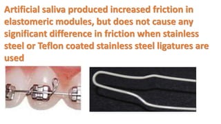 Artificial saliva produced increased friction in
elastomeric modules, but does not cause any
significant difference in friction when stainless
steel or Teflon coated stainless steel ligatures are
used
 