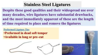 Despite these good qualities and their widespread use over
many decades, wire ligatures have substantial drawbacks,
and the most immediately apparent of these are the length
of time required to place and remove the ligatures.
Preformed Ligature Ties
•Preformed in dead soft temper
•Available in long or pre–cut
Stainless Steel Ligatures
 