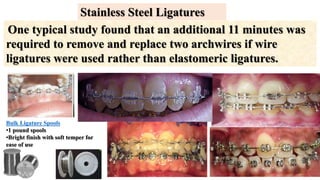 One typical study found that an additional 11 minutes was
required to remove and replace two archwires if wire
ligatures were used rather than elastomeric ligatures.
Bulk Ligature Spools
•1 pound spools
•Bright finish with soft temper for
ease of use
Stainless Steel Ligatures
 