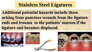 Stainless Steel Ligatures
Additional potential hazards include those
arising from puncture wounds from the ligature
ends and trauma to the patients’ mucosa if the
ligature end becomes displaced.
 
