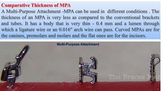 Comparative Thickness of MPA
A Multi-Purpose Attachment -MPA can be used in different conditions . The
thickness of an MPA is very less as compared to the conventional brackets
and tubes. It has a body that is very thin - 0.4 mm and a lumen through
which a ligature wire or an 0.016" arch wire can pass. Curved MPAs are for
the canines, premolars and molars and the flat ones are for the incisors.
Multi-Purpose Attachment
 