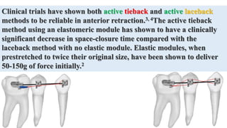Clinical trials have shown both active tieback and active laceback
methods to be reliable in anterior retraction.3, 4The active tieback
method using an elastomeric module has shown to have a clinically
significant decrease in space-closure time compared with the
laceback method with no elastic module. Elastic modules, when
prestretched to twice their original size, have been shown to deliver
50-150g of force initially.2
 