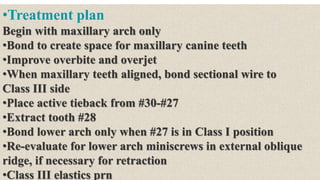 •Treatment plan
Begin with maxillary arch only
•Bond to create space for maxillary canine teeth
•Improve overbite and overjet
•When maxillary teeth aligned, bond sectional wire to
Class III side
•Place active tieback from #30-#27
•Extract tooth #28
•Bond lower arch only when #27 is in Class I position
•Re-evaluate for lower arch miniscrews in external oblique
ridge, if necessary for retraction
•Class III elastics prn
 