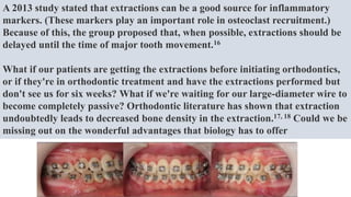 A 2013 study stated that extractions can be a good source for inflammatory
markers. (These markers play an important role in osteoclast recruitment.)
Because of this, the group proposed that, when possible, extractions should be
delayed until the time of major tooth movement.16
What if our patients are getting the extractions before initiating orthodontics,
or if they're in orthodontic treatment and have the extractions performed but
don't see us for six weeks? What if we're waiting for our large-diameter wire to
become completely passive? Orthodontic literature has shown that extraction
undoubtedly leads to decreased bone density in the extraction.17, 18 Could we be
missing out on the wonderful advantages that biology has to offer
 