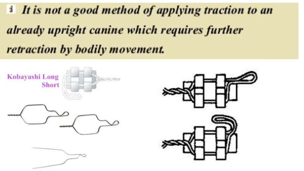 Methods of ligation