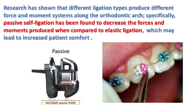 Ligation Sample What Is Ligation – DNA Ligase- Definition, Structure, Types, Functions ...