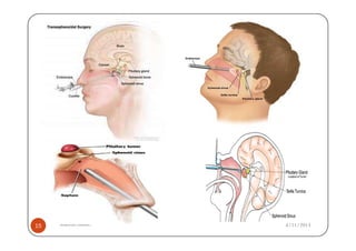 15   Shahzad Bashir.   4/11/2013
 