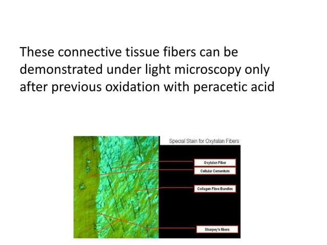 gingival connective tissue | PPTX | Dental Health | Diseases and Conditions