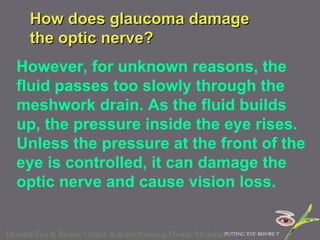 How does glaucoma damage the optic nerve?  However, for unknown reasons, the fluid passes too slowly through the meshwork drain. As the fluid builds up, the pressure inside the eye rises. Unless the pressure at the front of the eye is controlled, it can damage the optic nerve and cause vision loss.  