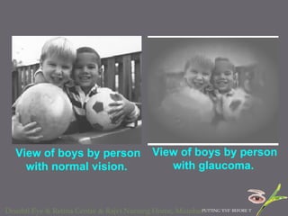 View of boys by person with normal vision.   View of boys by person with glaucoma.   
