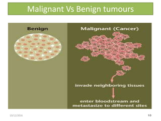 Malignant Vs Benign tumours
1010/12/2016
 