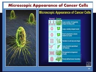 Invasion of malignant versus benign
tumours
Microscopic Appearance of Cancer Cells
1110/12/2016
 
