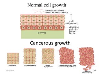 Cancerous growth
Normal cell growth
1610/12/2016
 