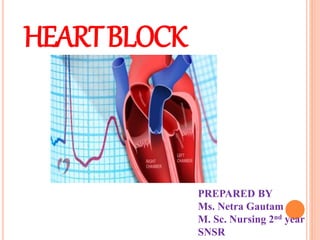 HEARTBLOCK
PREPARED BY
Ms. Netra Gautam
M. Sc. Nursing 2nd year
SNSR
 