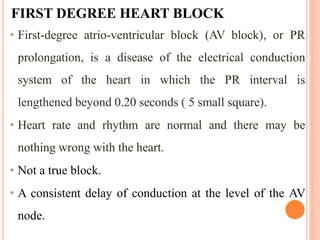 FIRST DEGREE HEART BLOCK
• First-degree atrio-ventricular block (AV block), or PR
prolongation, is a disease of the electrical conduction
system of the heart in which the PR interval is
lengthened beyond 0.20 seconds ( 5 small square).
• Heart rate and rhythm are normal and there may be
nothing wrong with the heart.
• Not a true block.
• A consistent delay of conduction at the level of the AV
node.
 