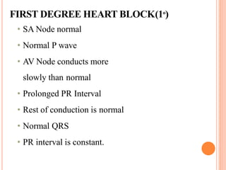 FIRST DEGREE HEART BLOCK(1º)
• SA Node normal
• Normal P wave
• AV Node conducts more
slowly than normal
• Prolonged PR Interval
• Rest of conduction is normal
• Normal QRS
• PR interval is constant.
 
