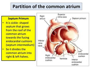 Partition of the common atrium
Septum Primum
• It is sickle- shaped
septum that grows
from the roof of the
common atrium
towards the fusing
endocardial cushions
(septum intermedium)
• So it divides the
common atrium into
right & left halves.
 