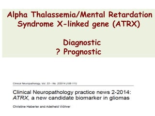 Alpha Thalassemia/Mental Retardation
Syndrome X-linked gene (ATRX)
Diagnostic
? Prognostic
 