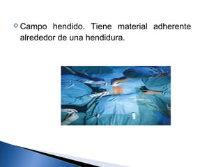  Campo  hendido. Tiene material adherente
 alrededor de una hendidura.
 