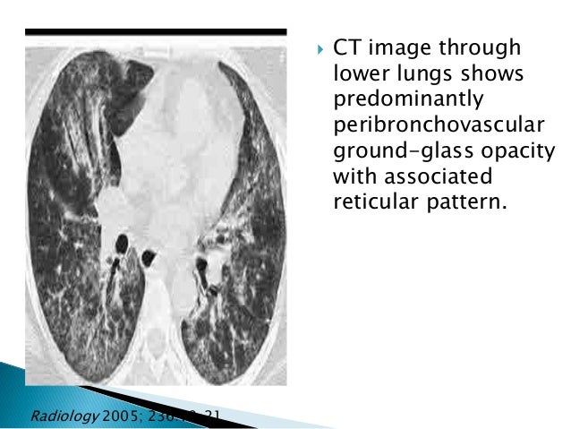 cellcept lung disorder