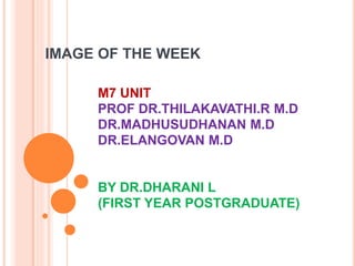 IMAGE OF THE WEEK
M7 UNIT
PROF DR.THILAKAVATHI.R M.D
DR.MADHUSUDHANAN M.D
DR.ELANGOVAN M.D
BY DR.DHARANI L
(FIRST YEAR POSTGRADUATE)
 