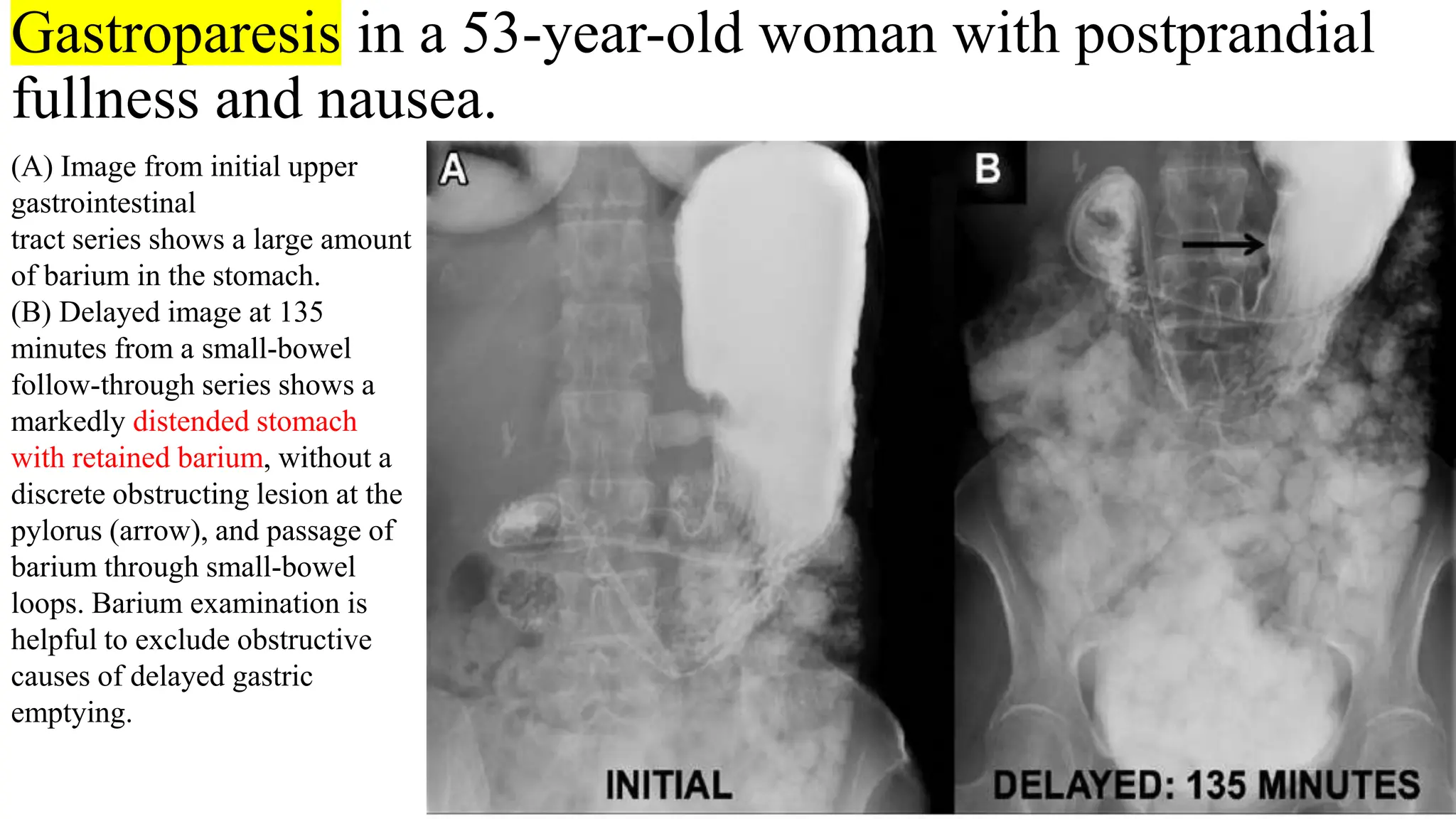 Imaging review Gastrointestinal motility disorders.pptx
