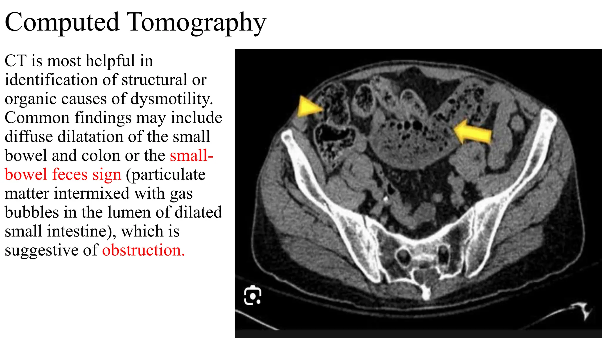 Imaging review Gastrointestinal motility disorders.pptx