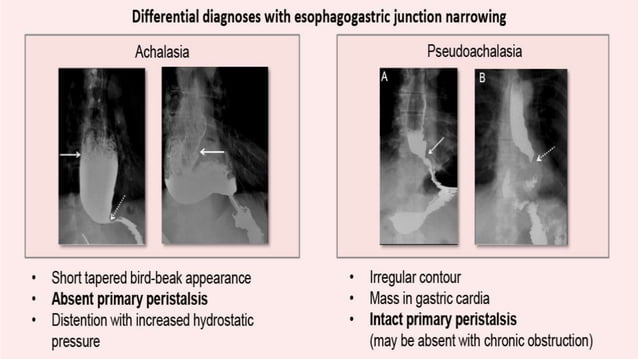 Imaging review Gastrointestinal motility disorders.pptx