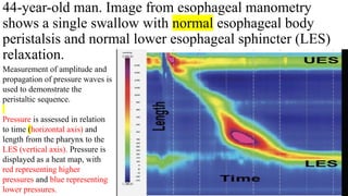 Imaging review Gastrointestinal motility disorders.pptx